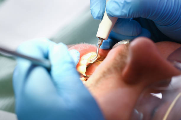 Best Dentist for Tooth Abscess  in Geistown, PA
