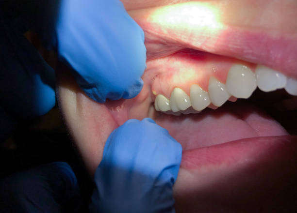 Best Tooth Pain Emergency Relief  in Geistown, PA